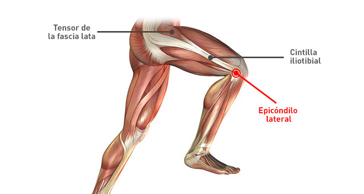 dolor parte externa rodilla